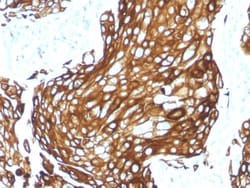 Biotium&nbsp;Cytokeratin, Acidic (Type I or LMW) (Epithelial Marker) (KRTL/1577R), CF640R conjugate, 0.1mg/mL