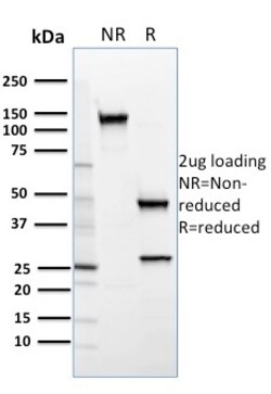 Biotium&nbsp;SREBP2(SREBP2/1579), CF640R conjugate, 0.1mg/mL