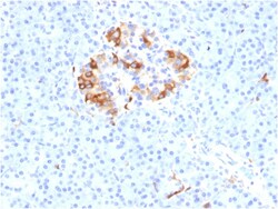 Biotium&nbsp;Ferritin, Light Chain (Node-Negative Breast Tumor Prognostic Marker)(FTL/1387), 1mg/mL