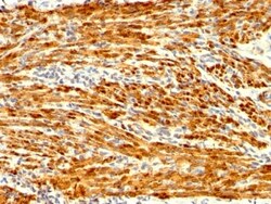 Biotium&nbsp;Calponin-1 (Smooth Muscle Marker) (CNN1/1408R), 1mg/mL