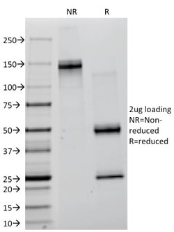Biotium&nbsp;Creatine Kinase-BB (CK-BB)(CKB/1268), 1mg/mL