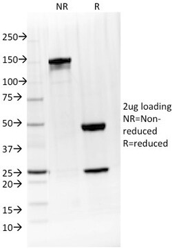Biotium&nbsp;IL-4 / Interleukin 4(IL4/1597), CF594 conjugate, 0.1mg/mL