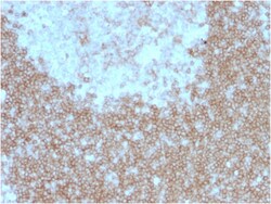 Biotium&nbsp;CD268 / BAFFR / TNFRSF13C(BAFFR/1557), 0.2mg/mL