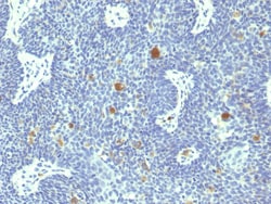 Biotium&nbsp;HPV-18 (Human Papilloma Virus 18)(HPV18/1297), CF405S conjugate, 0.1mg/mL