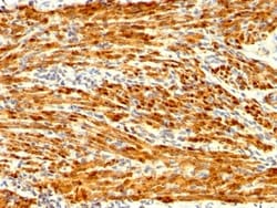 Biotium&nbsp;Calponin-1 (Smooth Muscle Marker) (CNN1/1408R), CF405S conjugate, 0.1mg/mL