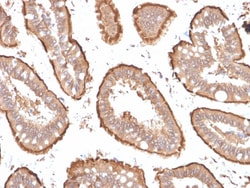 Biotium&nbsp;Villin (GI-Mucosal & Urogenital Brush Border Marker)(VIL1/1314 + VIL1/2376), CF594 conjugate, 0.1mg/mL