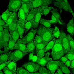 Biotium&nbsp;S100A4 (Marker of Tumor Metastasis) (S100A4/1482), CF594 conjugate, 0.1mg/mL