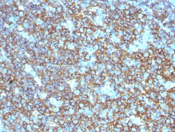 Biotium&nbsp;CD20 / MS4A1 (B-Cell Marker), 0.2mg/mL