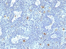 Biotium&nbsp;HPV-16 (Human Papilloma Virus 16)(HPV16/1295), CF488A conjugate, 0.1mg/mL