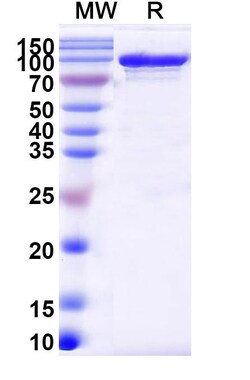 BIOHIPPO&nbsp;Endo S2/Endo-beta-N-acetylglucosaminidase, 1 mg
