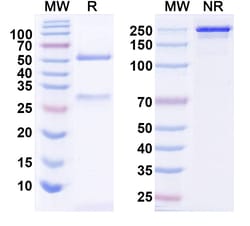 BIOHIPPO&nbsp;Anti-Clostridium Difficile Toxin B/tcdB Monoclonal Antibody (1A255), 100 µg