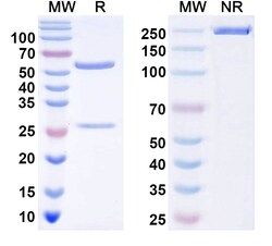 BIOHIPPO&nbsp;Anti-Human Alpha-1-antitrypsin/AAT Z polymer specifc Antibody (2C1), 100 µg