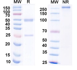 BIOHIPPO&nbsp;Anti-Mycobacterium tuberculosis icl1/Isocitrate lyase 1 Antibody (SAA2176), 100 µg