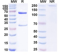 BIOHIPPO&nbsp;Anti-Human LIPG/Endothelial lipase Antibody (SAA1809), 100 µg
