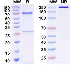 BIOHIPPO&nbsp;Anti-Bacillus anthracis cya/EF/Edema factor Antibody (E3#), 100 µg