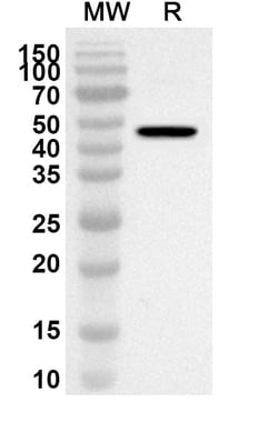 BIOHIPPO&nbsp;Anti-PIP4K2B/PIP4KII-beta Polyclonal Antibody, 100 µg