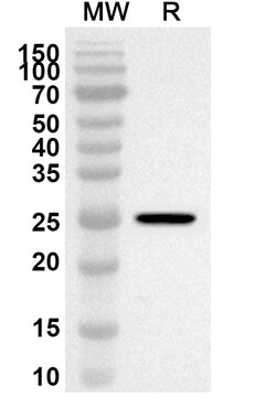 BIOHIPPO&nbsp;Anti-AGA Polyclonal Antibody, 100 µg