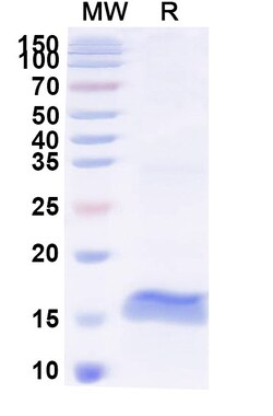 BIOHIPPO&nbsp;Anti-Pig Pancreatic alpha-amylase/AMY2 Nanobody (SAA2257), 100 µg
