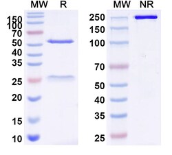 BIOHIPPO&nbsp;Anti-Bacillus anthracis cya/EF/Edema factor Antibody (B1), 100 µg
