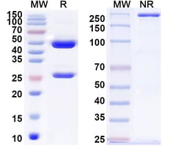 BIOHIPPO&nbsp;Anti-Helicobacter pylori ureA/Urease subunit alpha Antibody (HpU-18), 100 µg