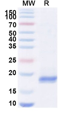 BIOHIPPO&nbsp;Anti-Human BLM Nanobody (SAA0979), 100 µg
