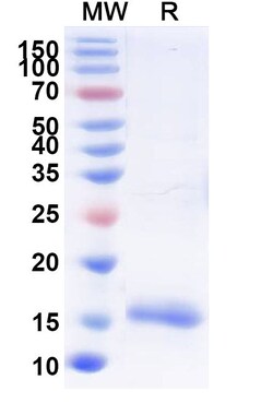 BIOHIPPO&nbsp;Anti-Wild turkey LYZ/Lysozyme C Nanobody (SAA0888), 100 µg