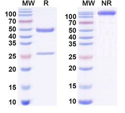 BIOHIPPO&nbsp;Anti-Human J1 epitope of COL2A1 Antibody (M2139), 100 µg