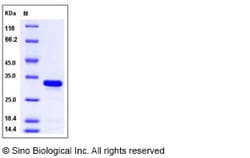 Sino Biological Recombinant Mouse BCL-xL/BCL2L1 Protein (aa 1-212, His