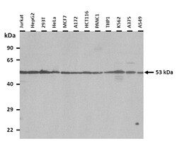 Aviva Systems Biology Corp MAP3K8 Antibody - C-terminal region (ARP30649_T100)