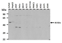 Aviva Systems Biology Corp LASS3 Antibody - N-terminal region (ARP31648_P050)