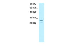 Aviva Systems Biology Corp OTX2 Antibody - N-terminal region (ARP32439_P050)