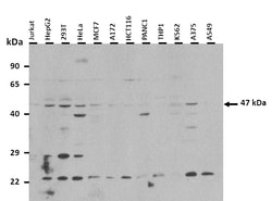 Aviva Systems Biology Corp PSMD11 Antibody - C-terminal region (ARP33002_T100)