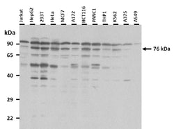 Aviva Systems Biology Corp NFE2L3 Antibody - middle region (ARP33727_P050)