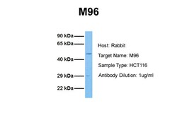 Aviva Systems Biology Corp M96 Antibody - middle region (ARP34292_P050)