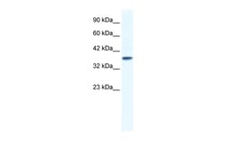 Aviva Systems Biology Corp KCNK3 Antibody - C-terminal region (ARP35090_T100)