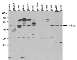 Aviva Systems Biology Corp KCNN4 Antibody - C-terminal region (ARP35098_P050)