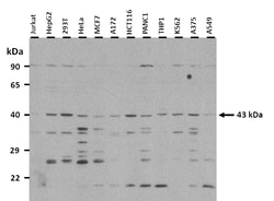 Aviva Systems Biology Corp POU4F2 Antibody - N-terminal region (ARP38501_P050)