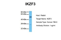 Aviva Systems Biology Corp IKZF3 Antibody - N-terminal region (ARP39004_P050)