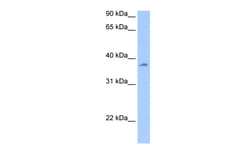 Aviva Systems Biology Corp RBMY1A1 Antibody - N-terminal region (ARP40257_P050)