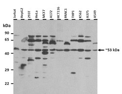Aviva Systems Biology Corp FUS Antibody - N-terminal region (ARP40278_P050)
