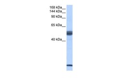Aviva Systems Biology Corp SF3B6 Antibody - middle region (ARP40829_P050)