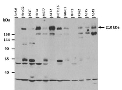 Aviva Systems Biology Corp TNRC6A Antibody - N-terminal region (ARP40956_P050)