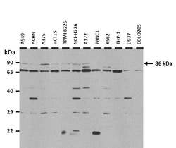 Aviva Systems Biology Corp DGCR8 Antibody - N-terminal region (ARP40984_P050)