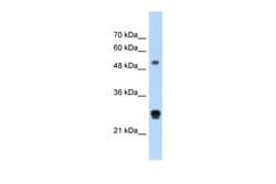 Aviva Systems Biology Corp IGSF1 Antibody - N-terminal region (ARP41953_T100)