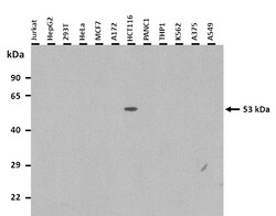 Aviva Systems Biology Corp TRIM72 Antibody - middle region (ARP42971_P050)