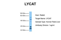 Aviva Systems Biology Corp LYCAT Antibody - middle region (ARP44426_P050)