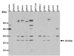 Aviva Systems Biology Corp PDPN Antibody - N-terminal region (ARP44528_P050)