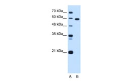 Aviva Systems Biology Corp TBX15 Antibody - C-terminal region (ARP47723_T100)