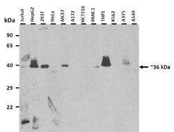 Aviva Systems Biology Corp NUDT17 Antibody - middle region (ARP48509_P050)