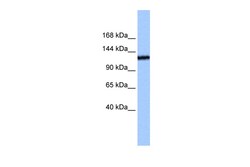 Aviva Systems Biology Corp TEX2 Antibody - N-terminal region (ARP49316_P050)